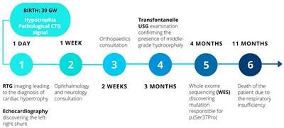 Case report: Rare among ultrarare—Clinical odyssey of a new patient with Ogden syndrome